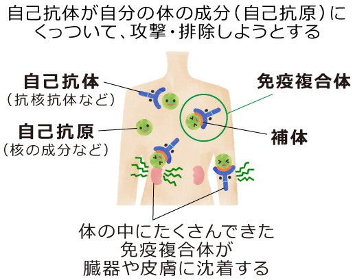 【SLEにおける免疫システムの異常】 